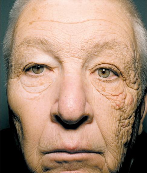 Keeping Your Skin Safe This Winter